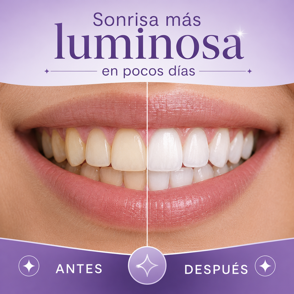 VioPearl - Tiras Blanqueadoras Violetas